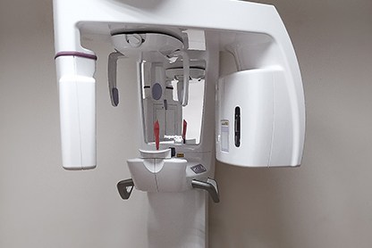 CBCT machine in dental office