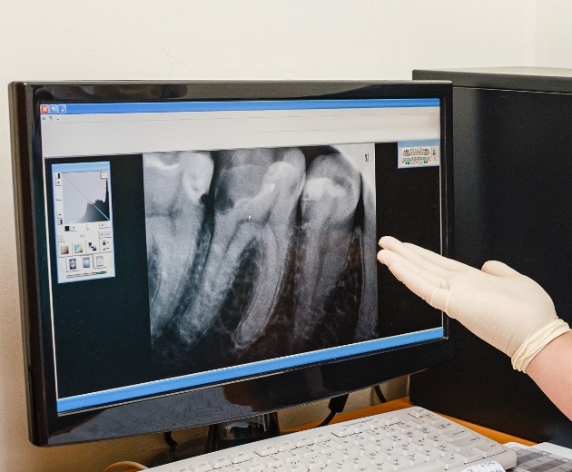 Oral surgeon and patient reviewing digital x-rays